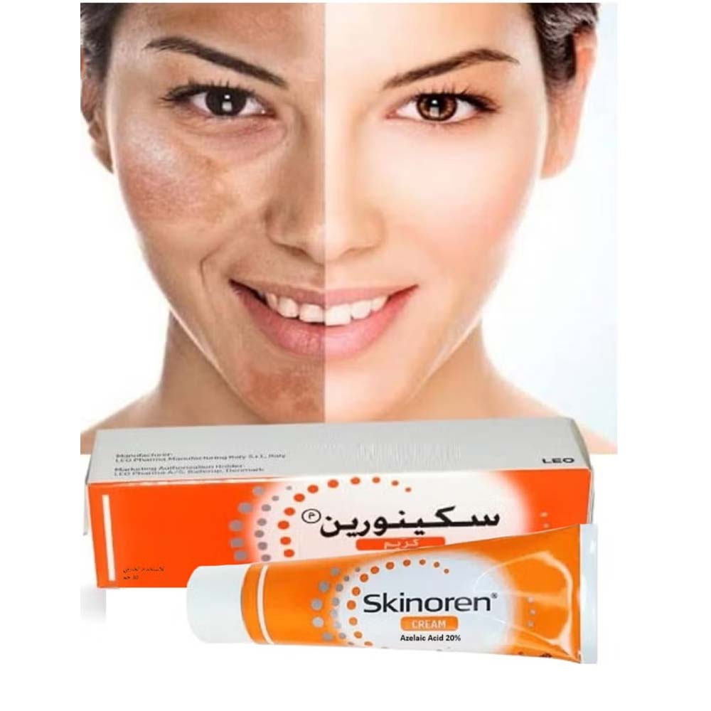 Skinoren Acne Treatment & Whitening Cream - 30g for All Skin Types, Azelaic Acid Formula for Clear, Even-Toned Skin Image