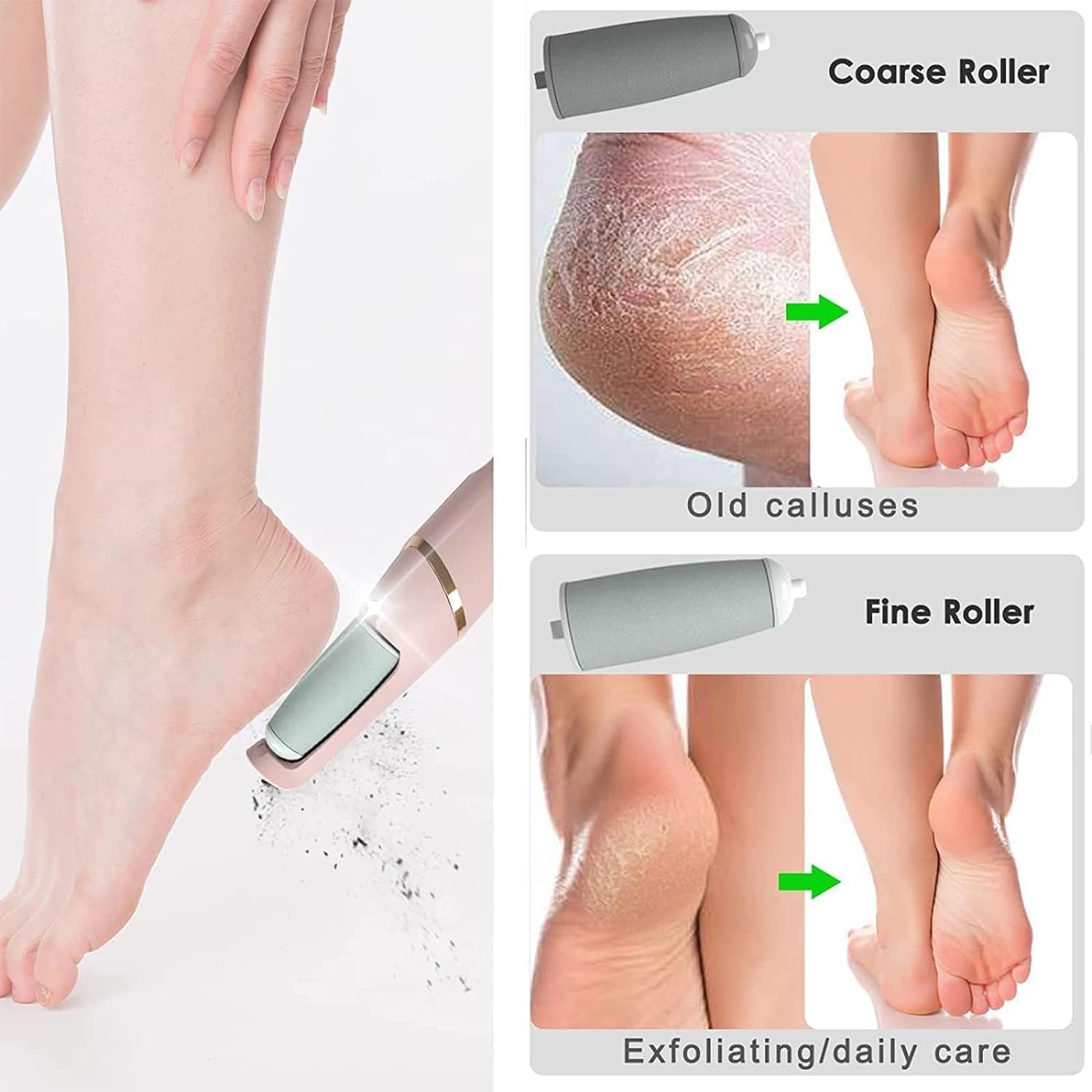 Flawless Pedi | The Ultimate Electronic Foot Care Tool with Dual Rollers & LED Precision | Smooth, Soft Feet at Home Image