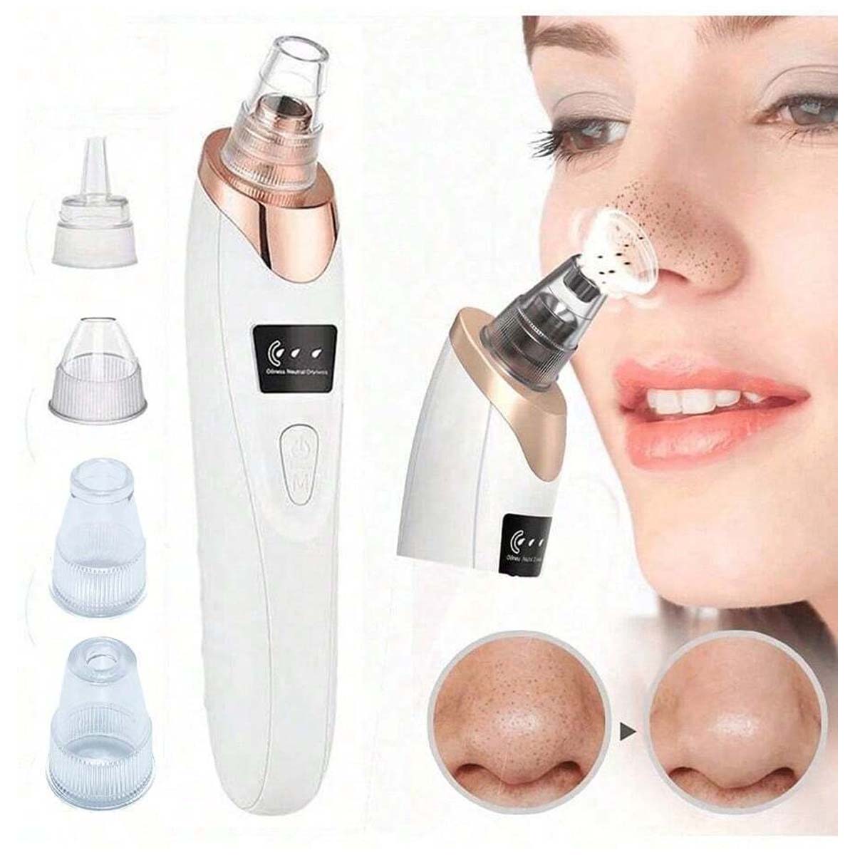 Electric Blackhead Vacuum Remover - Pore Cleanser & Pimple Sucker for Spa-Quality Facial at Home Image