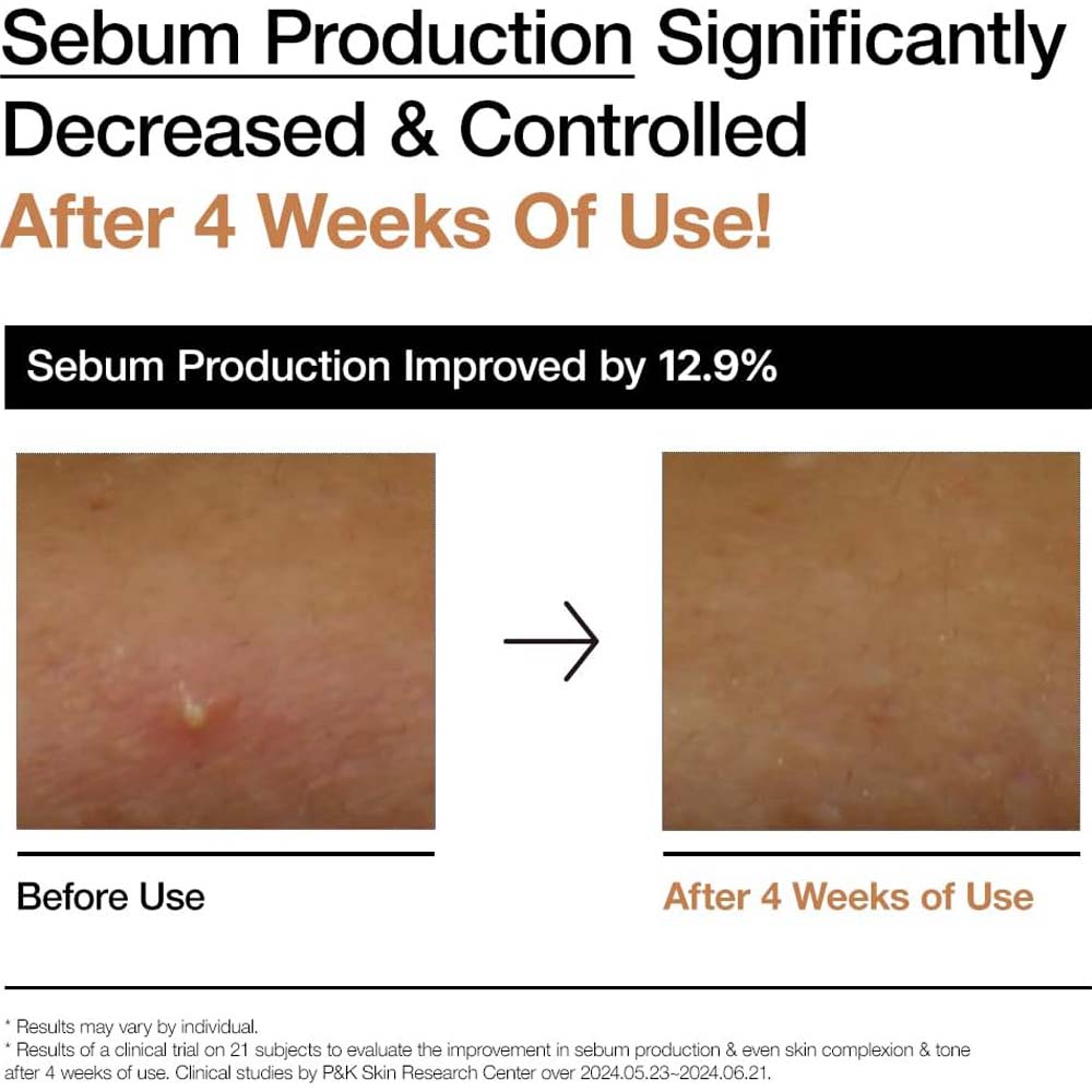 ANUA Rice 70 Glow Milky Toner. Nourishing rice water toner for glass skin. With Niacinamide & Ceramides. 250ml. Image