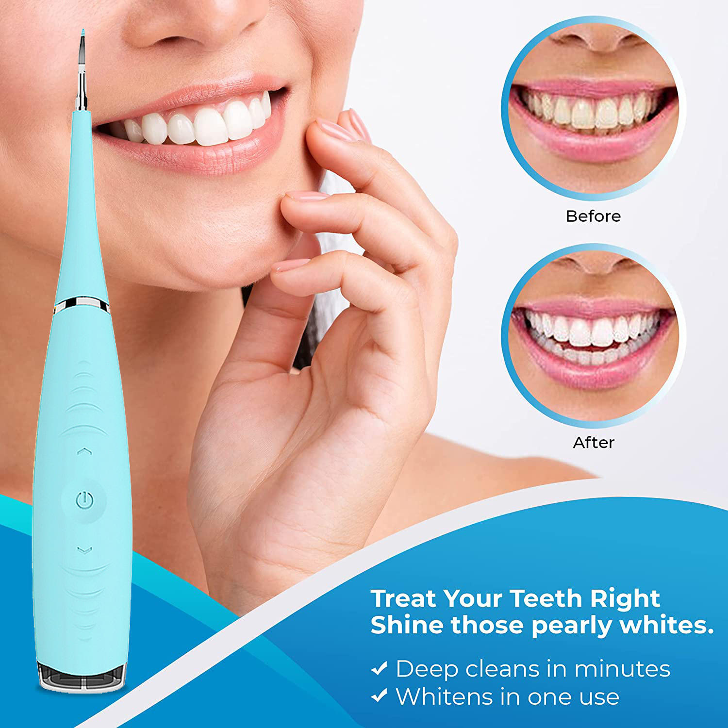 Electric Dental Calculus Remover - Sonic Tooth Tartar Plaque Removal Kit - Safe Stain Cleaner for Kids & Adults (Multi) Image