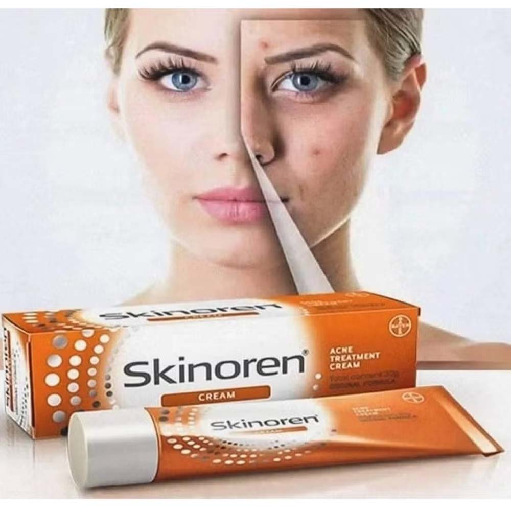 Skinoren Acne Treatment & Whitening Cream - 30g for All Skin Types, Azelaic Acid Formula for Clear, Even-Toned Skin Image
