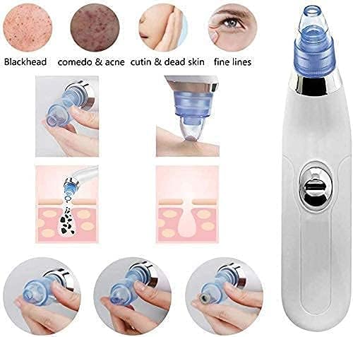 Blackhead & Whitehead Remover Electric Facial Beauty Machine | Your At-Home Spa Experience | Deep Cleansing and Pore Purifying Tool Image