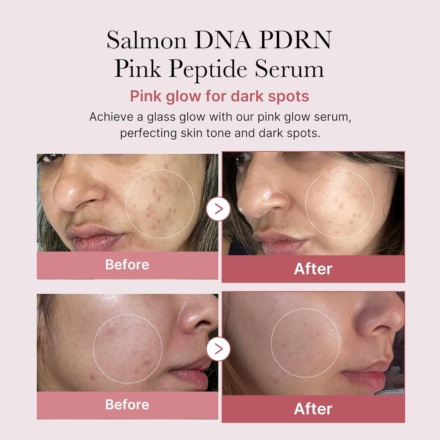 Medicube PDRN Pink Peptide Serum with Niacinamide for firming, hydrating & brightening skin tone. Korean glow serum. Image